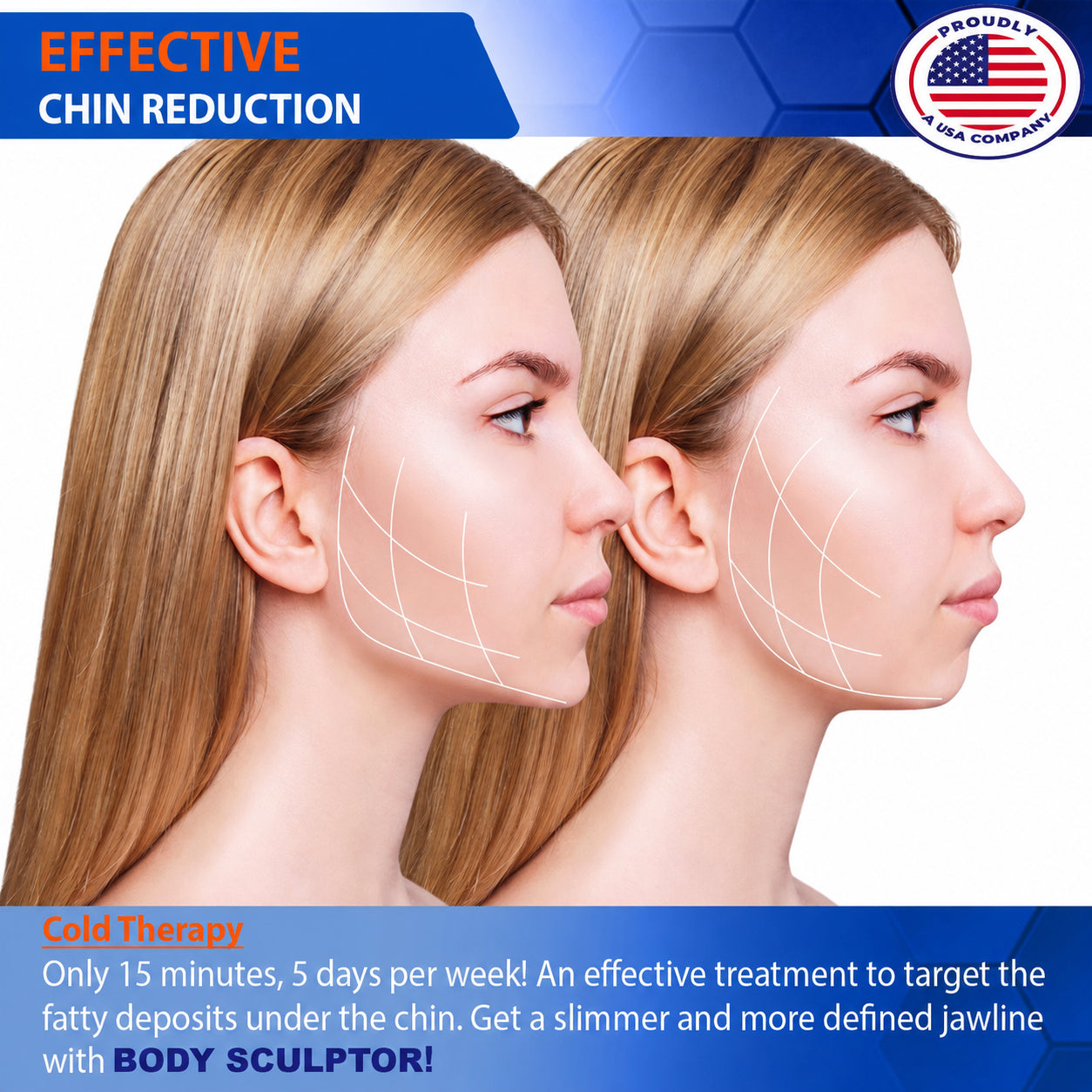 Chin Fat Reduction